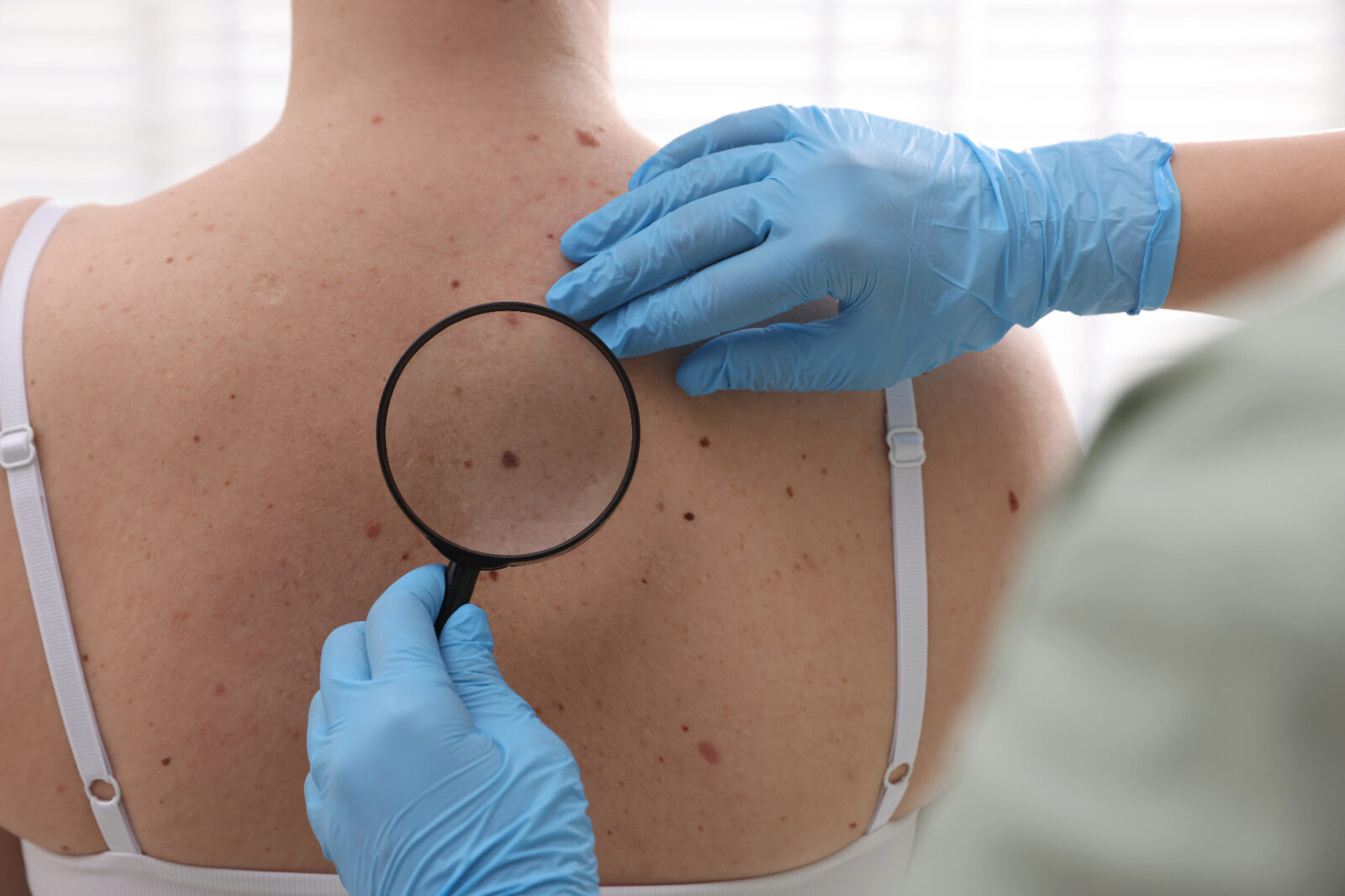 Beseda dermatologija ne pomeni le lepotnih izboljšav